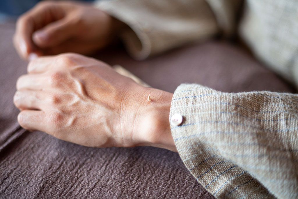 They can use it indirectly, with acupuncture needles, or burn it on the patient’s skin.